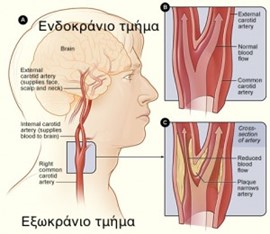 υπέρηχος εγκεφαλικών αγγείων1